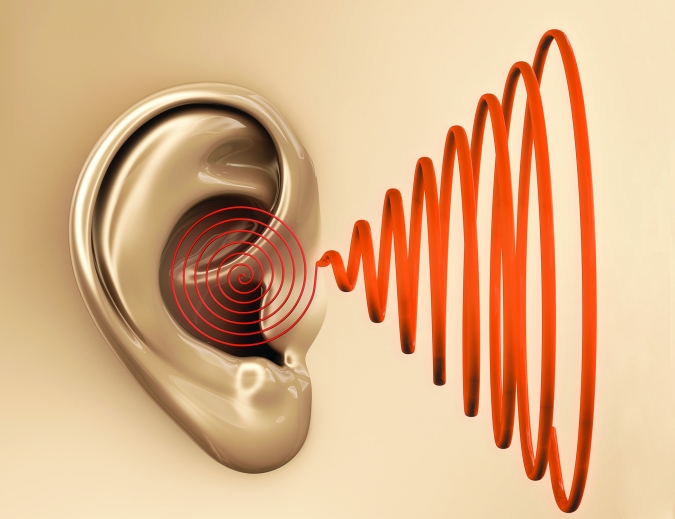 Tinnitus